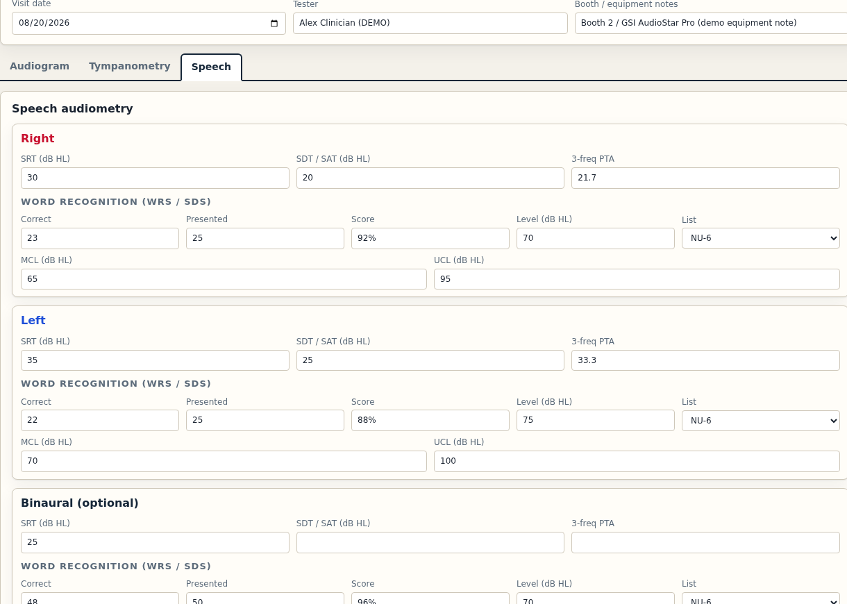 Speech audiometry tab with SRT, SDT, WRS, MCL, UCL, and binaural fields