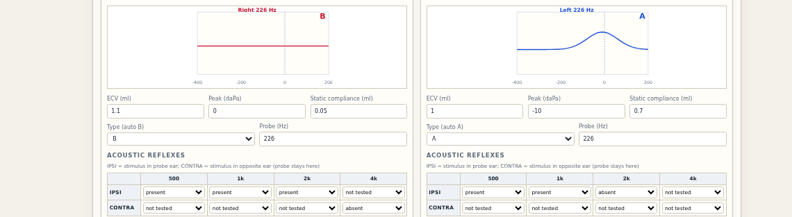 Tympanometry with Jerger type graphs and reflex grid